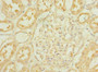Immunohistochemistry of paraffin-embedded human kidney tissue using CAC14503 at dilution of 1:100