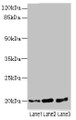 Western Blot, All lanes: TPRKB antibody at 5ug/ml, Lane 1: A549 whole cell lysate, Lane 2: Jurkat whole cell lysate, Lane 3: MCF-7 whole cell lysate, Secondary, Goat polyclonal to rabbit IgG at 1/10000 dilution, Predicted band size: 20, 17, 24 kDa, Observed band size: 20 kDa Western Blot, All lanes: TPRKB antibody at 5ug/ml, Lane 1: A549 whole cell lysate, Lane 2: Jurkat whole cell lysate, Lane 3: MCF-7 whole cell lysate, Secondary, Goat polyclonal to rabbit IgG at 1/10000 dilution, Predicted band size: 20, 17, 24 kDa, Observed band size: 20 kDa
