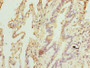 Immunohistochemistry of paraffin-embedded human lung tissue using CAC14514 at dilution of 1:100 Immunohistochemistry of paraffin-embedded human lung tissue using CAC14514 at dilution of 1:100