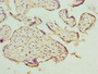 Immunohistochemistry of paraffin-embedded human placenta tissue using CAC14518 at dilution of 1:100 Immunohistochemistry of paraffin-embedded human placenta tissue using CAC14518 at dilution of 1:100