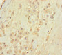 Immunohistochemistry of paraffin-embedded human placenta tissue using CAC14521 at dilution of 1:100 Immunohistochemistry of paraffin-embedded human placenta tissue using CAC14521 at dilution of 1:100