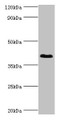 Western Blot, All lanes: DHRS7 antibody at 2ug/ml + MCF-7 whole cell lysate, Secondary, Goat polyclonal to rabbit IgG at 1/10000 dilution, Predicted band size: 39, 33 kDa, Observed band size: 39 kDa Western Blot, All lanes: DHRS7 antibody at 2ug/ml + MCF-7 whole cell lysate, Secondary, Goat polyclonal to rabbit IgG at 1/10000 dilution, Predicted band size: 39, 33 kDa, Observed band size: 39 kDa