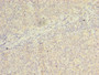 Immunohistochemistry of paraffin-embedded human tonsil tissue using CAC14524 at dilution of 1:100 Immunohistochemistry of paraffin-embedded human tonsil tissue using CAC14524 at dilution of 1:100