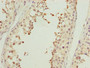 Immunohistochemistry of paraffin-embedded human testis tissue using CAC14525 at dilution of 1:100 Immunohistochemistry of paraffin-embedded human testis tissue using CAC14525 at dilution of 1:100