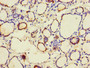 Immunohistochemistry of paraffin-embedded human thyroid tissue using CAC14528 at dilution of 1:100 Immunohistochemistry of paraffin-embedded human thyroid tissue using CAC14528 at dilution of 1:100