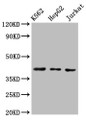 Western Blot, Positive WB detected in: K562 whole cell lysate, HepG2 whole cell lysate, Jurkat whole cell lysate, All lanes: CXCR3 antibody at 3ug/ml, Secondary, Goat polyclonal to rabbit IgG at 1/50000 dilution, Predicted band size: 41, 46, 29 kDa, Observed band size: 41 kDa Western Blot, Positive WB detected in: K562 whole cell lysate, HepG2 whole cell lysate, Jurkat whole cell lysate, All lanes: CXCR3 antibody at 3ug/ml, Secondary, Goat polyclonal to rabbit IgG at 1/50000 dilution, Predicted band size: 41, 46, 29 kDa, Observed band size: 41 kDa