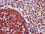 IHC image of CAC14529 diluted at 1:1200 and staining in paraffin-embedded human lymph node tissue performed on a Leica BondTM system. After dewaxing and hydration, antigen retrieval was mediated by high pressure in a citrate buffer (pH 6.0). Section was blocked with 10% normal goat serum 30min at RT. Then primary antibody (1% BSA) was incubated at 4°C overnight. The primary is detected by a biotinylated secondary antibody and visualized using an HRP conjugated SP system. IHC image of CAC14529 diluted at 1:1200 and staining in paraffin-embedded human lymph node tissue performed on a Leica BondTM system. After dewaxing and hydration, antigen retrieval was mediated by high pressure in a citrate buffer (pH 6.0). Section was blocked with 10% normal goat serum 30min at RT. Then primary antibody (1% BSA) was incubated at 4°C overnight. The primary is detected by a biotinylated secondary antibody and visualized using an HRP conjugated SP system.