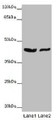 Western Blot, All lanes: GATA1 antibody at 7ug/ml, Lane 1: MCF-7 whole cell lysate, Lane 2: A549 whole cell lysate, Secondary, Goat polyclonal to rabbit IgG at 1/10000 dilution, Predicted band size: 43, 36, 35 kDa, Observed band size: 43 kDa Western Blot, All lanes: GATA1 antibody at 7ug/ml, Lane 1: MCF-7 whole cell lysate, Lane 2: A549 whole cell lysate, Secondary, Goat polyclonal to rabbit IgG at 1/10000 dilution, Predicted band size: 43, 36, 35 kDa, Observed band size: 43 kDa