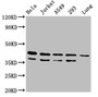Western Blot, Positive WB detected in: Hela whole cell lysate, Jurkat whole cell lysate, A549 whole cell lysate, 293 whole cell lysate, Rat lung tissue, All lanes: MAPK1 antibody at 4.8ug/ml, Secondary, Goat polyclonal to rabbit IgG at 1/50000 dilution, Predicted band size: 42, 37 kDa, Observed band size: 42, 37 kDa