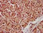 IHC image of CAC14542 diluted at 1:600 and staining in paraffin-embedded human pancreatic tissue performed on a Leica BondTM system. After dewaxing and hydration, antigen retrieval was mediated by high pressure in a citrate buffer (pH 6.0). Section was blocked with 10% normal goat serum 30min at RT. Then primary antibody (1% BSA) was incubated at 4°C overnight. The primary is detected by a biotinylated secondary antibody and visualized using an HRP conjugated SP system.