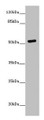 Western Blot, All lanes: PRMT3 antibody at 7ug/ml + MCF-7 whole cell lysate, Secondary, Goat polyclonal to rabbit IgG at 1/10000 dilution, Predicted band size: 60, 53 kDa, Observed band size: 53 kDa Western Blot, All lanes: PRMT3 antibody at 7ug/ml + MCF-7 whole cell lysate, Secondary, Goat polyclonal to rabbit IgG at 1/10000 dilution, Predicted band size: 60, 53 kDa, Observed band size: 53 kDa