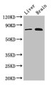 Western Blot, Positive WB detected in: Mouse liver tissue, Mouse brain tissue, All lanes: TBK1 antibody at 3ug/ml, Secondary, Goat polyclonal to rabbit IgG at 1/50000 dilution, Predicted band size: 84 kDa, Observed band size: 84 kDa Western Blot, Positive WB detected in: Mouse liver tissue, Mouse brain tissue, All lanes: TBK1 antibody at 3ug/ml, Secondary, Goat polyclonal to rabbit IgG at 1/50000 dilution, Predicted band size: 84 kDa, Observed band size: 84 kDa