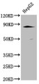 Western Blot, Positive WB detected in: HepG2 whole cell lysate, All lanes: TBK1 antibody at 1:2000, Secondary, Goat polyclonal to rabbit IgG at 1/50000 dilution, Predicted band size: 84 kDa, Observed band size: 84 kDa Western Blot, Positive WB detected in: HepG2 whole cell lysate, All lanes: TBK1 antibody at 1:2000, Secondary, Goat polyclonal to rabbit IgG at 1/50000 dilution, Predicted band size: 84 kDa, Observed band size: 84 kDa