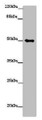 Western Blot, All lanes: TUBG1 antibody at 14ug/ml + Hela whole cell lysate, Secondary, Goat polyclonal to rabbit IgG at 1/10000 dilution, Predicted band size: 52 kDa, Observed band size: 52 kDa Western Blot, All lanes: TUBG1 antibody at 14ug/ml + Hela whole cell lysate, Secondary, Goat polyclonal to rabbit IgG at 1/10000 dilution, Predicted band size: 52 kDa, Observed band size: 52 kDa