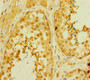 Immunohistochemistry of paraffin-embedded human testis tissue using CAC14557 at dilution of 1:100 Immunohistochemistry of paraffin-embedded human testis tissue using CAC14557 at dilution of 1:100