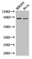 Western Blot, Positive WB detected in: HEK293 whole cell lysate, Hela whole cell lysate, All lanes: MLH1 antibody at 3ug/ml, Secondary, Goat polyclonal to rabbit IgG at 1/50000 dilution, Predicted band size: 85, 59, 74 kDa, Observed band size: 85 kDa Western Blot, Positive WB detected in: HEK293 whole cell lysate, Hela whole cell lysate, All lanes: MLH1 antibody at 3ug/ml, Secondary, Goat polyclonal to rabbit IgG at 1/50000 dilution, Predicted band size: 85, 59, 74 kDa, Observed band size: 85 kDa