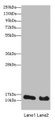 Western Blot, All lanes: HIST2H3A antibody at 14 ug/ml, Lane 1: Mouse liver tissue, Lane 2: Mouse kidney tissue, Secondary, Goat polyclonal to rabbit IgG at 1/10000 dilution, Predicted band size: 15 kDa, Observed band size: 15 kDa Western Blot, All lanes: HIST2H3A antibody at 14 ug/ml, Lane 1: Mouse liver tissue, Lane 2: Mouse kidney tissue, Secondary, Goat polyclonal to rabbit IgG at 1/10000 dilution, Predicted band size: 15 kDa, Observed band size: 15 kDa