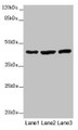 Western Blot, All lanes: MTERF4 antibody at 2 ug/ml, Lane 1: Mouse kidney tissue, Lane 2: HL60 whole cell lysate, Lane 3: A549 whole cell lysate, Secondary, Goat polyclonal to rabbit IgG at 1/10000 dilution, Predicted band size: 44 kDa, Observed band size: 44 kDa Western Blot, All lanes: MTERF4 antibody at 2 ug/ml, Lane 1: Mouse kidney tissue, Lane 2: HL60 whole cell lysate, Lane 3: A549 whole cell lysate, Secondary, Goat polyclonal to rabbit IgG at 1/10000 dilution, Predicted band size: 44 kDa, Observed band size: 44 kDa