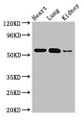 Western Blot, Positive WB detected in: Mouse heart tissue, Mouse lung tissue, Mouse kidney tissue, All lanes: SMAD5 antibody at 3ug/ml, Secondary, Goat polyclonal to rabbit IgG at 1/50000 dilution, Predicted band size: 53 kDa, Observed band size: 53 kDa Western Blot, Positive WB detected in: Mouse heart tissue, Mouse lung tissue, Mouse kidney tissue, All lanes: SMAD5 antibody at 3ug/ml, Secondary, Goat polyclonal to rabbit IgG at 1/50000 dilution, Predicted band size: 53 kDa, Observed band size: 53 kDa