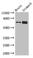 Western Blot, Positive WB detected in: Mouse brain tissue, Mouse stomach tissue, All lanes: EXD2 antibody at 2.8ug/ml, Secondary, Goat polyclonal to rabbit IgG at 1/50000 dilution, Predicted band size: 71, 57 kDa, Observed band size: 71 kDa Western Blot, Positive WB detected in: Mouse brain tissue, Mouse stomach tissue, All lanes: EXD2 antibody at 2.8ug/ml, Secondary, Goat polyclonal to rabbit IgG at 1/50000 dilution, Predicted band size: 71, 57 kDa, Observed band size: 71 kDa