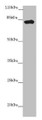 Western Blot, All lanes: LRCH1 antibody at 15ug/ml + Hela whole cell lysate, Secondary, Goat polyclonal to rabbit IgG at 1/10000 dilution, Predicted band size: 81, 78, 85 kDa, Observed band size: 81 kDa