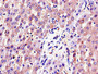 Immunohistochemistry of paraffin-embedded human liver tissue using CAC14579 at dilution of 1:100 Immunohistochemistry of paraffin-embedded human liver tissue using CAC14579 at dilution of 1:100