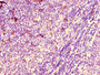 Immunohistochemistry of paraffin-embedded human lymph node tissue using CAC14580 at dilution of 1:100 Immunohistochemistry of paraffin-embedded human lymph node tissue using CAC14580 at dilution of 1:100
