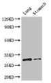 Western Blot, Positive WB detected in: Mouse lung tissue, Mouse stomach tissue, All lanes: TNFRSF5 antibody at 3.2ug/ml, Secondary, Goat polyclonal to rabbit IgG at 1/50000 dilution, Predicted band size: 31, 23 kDa, Observed band size: 31 kDa Western Blot, Positive WB detected in: Mouse lung tissue, Mouse stomach tissue, All lanes: TNFRSF5 antibody at 3.2ug/ml, Secondary, Goat polyclonal to rabbit IgG at 1/50000 dilution, Predicted band size: 31, 23 kDa, Observed band size: 31 kDa
