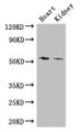 Western Blot, Positive WB detected in: Mouse heart tissue, Mouse kidney tissue, All lanes: CYP11B1 antibody at 3ug/ml, Secondary, Goat polyclonal to rabbit IgG at 1/50000 dilution, Predicted band size: 58, 50 kDa, Observed band size: 58 kDa Western Blot, Positive WB detected in: Mouse heart tissue, Mouse kidney tissue, All lanes: CYP11B1 antibody at 3ug/ml, Secondary, Goat polyclonal to rabbit IgG at 1/50000 dilution, Predicted band size: 58, 50 kDa, Observed band size: 58 kDa