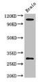 Western Blot, Positive WB detected in: Mouse brain tissue, All lanes: EPHA1 antibody at 3ug/ml, Secondary, Goat polyclonal to rabbit IgG at 1/50000 dilution, Predicted band size: 109, 53, 52 kDa, Observed band size: 109, 30 kDa Western Blot, Positive WB detected in: Mouse brain tissue, All lanes: EPHA1 antibody at 3ug/ml, Secondary, Goat polyclonal to rabbit IgG at 1/50000 dilution, Predicted band size: 109, 53, 52 kDa, Observed band size: 109, 30 kDa