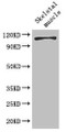 Western Blot, Positive WB detected in: Mouse skeletal muscle tissue, All lanes: EPHB6 antibody at 2ug/ml, Secondary, Goat polyclonal to rabbit IgG at 1/50000 dilution, Predicted band size: 111, 82, 58 kDa, Observed band size: 111 kDa Western Blot, Positive WB detected in: Mouse skeletal muscle tissue, All lanes: EPHB6 antibody at 2ug/ml, Secondary, Goat polyclonal to rabbit IgG at 1/50000 dilution, Predicted band size: 111, 82, 58 kDa, Observed band size: 111 kDa