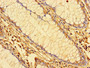 Immunohistochemistry of paraffin-embedded human colon tissue using CAC14591 at dilution of 1:100 Immunohistochemistry of paraffin-embedded human colon tissue using CAC14591 at dilution of 1:100