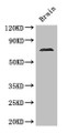Western Blot, Positive WB detected in: Mouse brain tissue, All lanes: MAK antibody at 2.8ug/ml, Secondary, Goat polyclonal to rabbit IgG at 1/50000 dilution, Predicted band size: 71, 74, 67 kDa, Observed band size: 71 kDa Western Blot, Positive WB detected in: Mouse brain tissue, All lanes: MAK antibody at 2.8ug/ml, Secondary, Goat polyclonal to rabbit IgG at 1/50000 dilution, Predicted band size: 71, 74, 67 kDa, Observed band size: 71 kDa