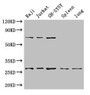 Western Blot, Positive WB detected in: Raji whole cell lysate, Jurkat whole cell lysate, SH-SY5Y whole cell lysate, Mouse spleen tissue, Mouse lung tissue, All lanes: YWHAZ antibody at 3.4ug/ml, Secondary, Goat polyclonal to rabbit IgG at 1/50000 dilution, Predicted band size: 28, 20 kDa, Observed band size: 28, 70 kDa Western Blot, Positive WB detected in: Raji whole cell lysate, Jurkat whole cell lysate, SH-SY5Y whole cell lysate, Mouse spleen tissue, Mouse lung tissue, All lanes: YWHAZ antibody at 3.4ug/ml, Secondary, Goat polyclonal to rabbit IgG at 1/50000 dilution, Predicted band size: 28, 20 kDa, Observed band size: 28, 70 kDa