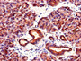 IHC image of CAC14594 diluted at 1:1000 and staining in paraffin-embedded human pancreatic tissue performed on a Leica BondTM system. After dewaxing and hydration, antigen retrieval was mediated by high pressure in a citrate buffer (pH 6.0). Section was blocked with 10% normal goat serum 30min at RT. Then primary antibody (1% BSA) was incubated at 4°C overnight. The primary is detected by a biotinylated secondary antibody and visualized using an HRP conjugated SP system. IHC image of CAC14594 diluted at 1:1000 and staining in paraffin-embedded human pancreatic tissue performed on a Leica BondTM system. After dewaxing and hydration, antigen retrieval was mediated by high pressure in a citrate buffer (pH 6.0). Section was blocked with 10% normal goat serum 30min at RT. Then primary antibody (1% BSA) was incubated at 4°C overnight. The primary is detected by a biotinylated secondary antibody and visualized using an HRP conjugated SP system.