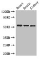Western Blot, Positive WB detected in: Mouse heart tissue, Mouse brain tissue, Mouse kidney tissue, All lanes: SH3BP5 antibody at 3ug/ml, Secondary, Goat polyclonal to rabbit IgG at 1/50000 dilution, Predicted band size: 51, 33 kDa, Observed band size: 51 kDa