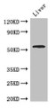 Western Blot, Positive WB detected in: Mouse liver tissue, All lanes: SLC18A1 antibody at 2.7ug/ml, Secondary, Goat polyclonal to rabbit IgG at 1/50000 dilution, Predicted band size: 57, 51, 53 kDa, Observed band size: 57 kDa Western Blot, Positive WB detected in: Mouse liver tissue, All lanes: SLC18A1 antibody at 2.7ug/ml, Secondary, Goat polyclonal to rabbit IgG at 1/50000 dilution, Predicted band size: 57, 51, 53 kDa, Observed band size: 57 kDa