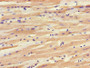 IHC image of CAC14600 diluted at 1:1200 and staining in paraffin-embedded human heart tissue performed on a Leica BondTM system. After dewaxing and hydration, antigen retrieval was mediated by high pressure in a citrate buffer (pH 6.0). Section was blocked with 10% normal goat serum 30min at RT. Then primary antibody (1% BSA) was incubated at 4°C overnight. The primary is detected by a biotinylated secondary antibody and visualized using an HRP conjugated SP system. IHC image of CAC14600 diluted at 1:1200 and staining in paraffin-embedded human heart tissue performed on a Leica BondTM system. After dewaxing and hydration, antigen retrieval was mediated by high pressure in a citrate buffer (pH 6.0). Section was blocked with 10% normal goat serum 30min at RT. Then primary antibody (1% BSA) was incubated at 4°C overnight. The primary is detected by a biotinylated secondary antibody and visualized using an HRP conjugated SP system.