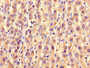 IHC image of CAC14600 diluted at 1:1200 and staining in paraffin-embedded human liver tissue performed on a Leica BondTM system. After dewaxing and hydration, antigen retrieval was mediated by high pressure in a citrate buffer (pH 6.0). Section was blocked with 10% normal goat serum 30min at RT. Then primary antibody (1% BSA) was incubated at 4°C overnight. The primary is detected by a biotinylated secondary antibody and visualized using an HRP conjugated SP system. IHC image of CAC14600 diluted at 1:1200 and staining in paraffin-embedded human liver tissue performed on a Leica BondTM system. After dewaxing and hydration, antigen retrieval was mediated by high pressure in a citrate buffer (pH 6.0). Section was blocked with 10% normal goat serum 30min at RT. Then primary antibody (1% BSA) was incubated at 4°C overnight. The primary is detected by a biotinylated secondary antibody and visualized using an HRP conjugated SP system.