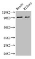 Western Blot, Positive WB detected in: Mouse brain tissue, Mouse kidney tissue, All lanes: SLC9A1 antibody at 3ug/ml, Secondary, Goat polyclonal to rabbit IgG at 1/50000 dilution, Predicted band size: 91, 62 kDa, Observed band size: 91 kDa Western Blot, Positive WB detected in: Mouse brain tissue, Mouse kidney tissue, All lanes: SLC9A1 antibody at 3ug/ml, Secondary, Goat polyclonal to rabbit IgG at 1/50000 dilution, Predicted band size: 91, 62 kDa, Observed band size: 91 kDa