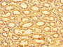 Immunohistochemistry of paraffin-embedded human kidney tissue using CAC14601 at dilution of 1:100 Immunohistochemistry of paraffin-embedded human kidney tissue using CAC14601 at dilution of 1:100