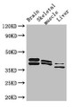 Western Blot, Positive WB detected in: Mouse brain tissue, Mouse skeletal muscle tissue, Mouse liver tissue, All lanes: ALDOC antibody at 3ug/ml, Secondary, Goat polyclonal to rabbit IgG at 1/50000 dilution, Predicted band size: 40 kDa, Observed band size: 40, 36, 42 kDa Western Blot, Positive WB detected in: Mouse brain tissue, Mouse skeletal muscle tissue, Mouse liver tissue, All lanes: ALDOC antibody at 3ug/ml, Secondary, Goat polyclonal to rabbit IgG at 1/50000 dilution, Predicted band size: 40 kDa, Observed band size: 40, 36, 42 kDa