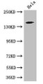 Western Blot, Positive WB detected in: Hela whole cell lysate, All lanes: TNRC6C antibody at 3.4ug/ml, Secondary, Goat polyclonal to rabbit IgG at 1/50000 dilution, Predicted band size: 176, 180 kDa, Observed band size: 176 kDa