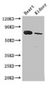 Western Blot, Positive WB detected in: Mouse heart tissue, Mouse kidney tissue, All lanes: MED17 antibody at 2.8ug/ml, Secondary, Goat polyclonal to rabbit IgG at 1/50000 dilution, Predicted band size: 73, 16 kDa, Observed band size: 73 kDa