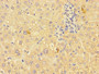 Immunohistochemistry of paraffin-embedded human liver tissue using CAC14624 at dilution of 1:100