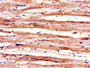 Immunohistochemistry of paraffin-embedded human heart tissue using CAC14625 at dilution of 1:100