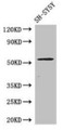 Western BlotPositive WB detected in: SH-SY5Y whole cell lysateAll lanes: METTL14 antibody at 1:1000SecondaryGoat polyclonal to rabbit IgG at 1/50000 dilution Predicted band size: 53 kDaObserved band size: 53 kDa