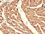 Immunohistochemistry of paraffin-embedded human heart tissue using CAC14630 at dilution of 1:100