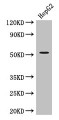 Western Blot, Positive WB detected in: HepG2 whole cell lysate, All lanes: DAPK3 antibody at 3.4ug/ml, Secondary, Goat polyclonal to rabbit IgG at 1/50000 dilution, Predicted band size: 53, 38 kDa, Observed band size: 53 kDa