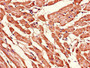 Immunohistochemistry of paraffin-embedded human heart tissue using CAC14645 at dilution of 1:100